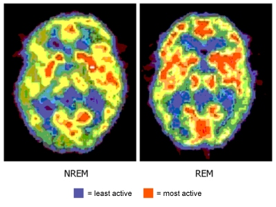 REM sleep and brain activity